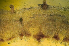 Puccinia graminis