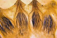 Claviceps purpurea