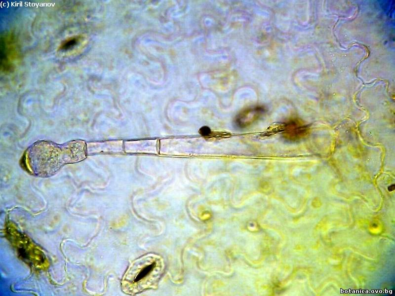 Жлезиста власинка върху епидерма на Pelargonium zonale