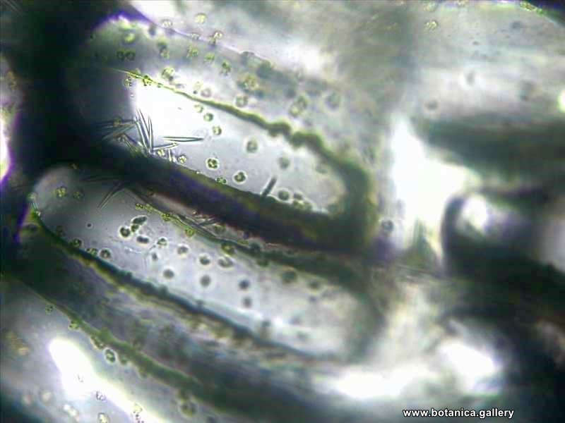 Водоносни паренхимни клетки от Aptenia cordifolia