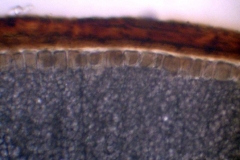 Алейронов слой и ендосперм от семе на Triticum aestivum