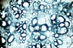 резервен паренхим от грудка на Solanum tuberosum