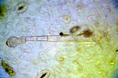 Жлезиста власинка върху епидерма на Pelargonium zonale