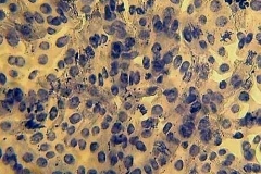 Митотично делене във връхна коренова меристема от Rumex tuberosus