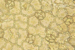 Долна епидерма от лист на от Pyrola chlorantha