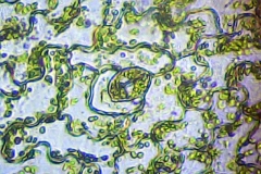 Долна епидерма от лист на Nephrolepis exaltata