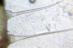 парливи трихоми от Urtica dioica