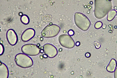 Скорбялни зърна от Solanum tuberosum