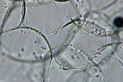 Клетки от сърцевина на Sambucus nigra