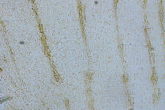 Taraxacum cf. officinale - млечни цеви