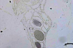 marchantia222_s